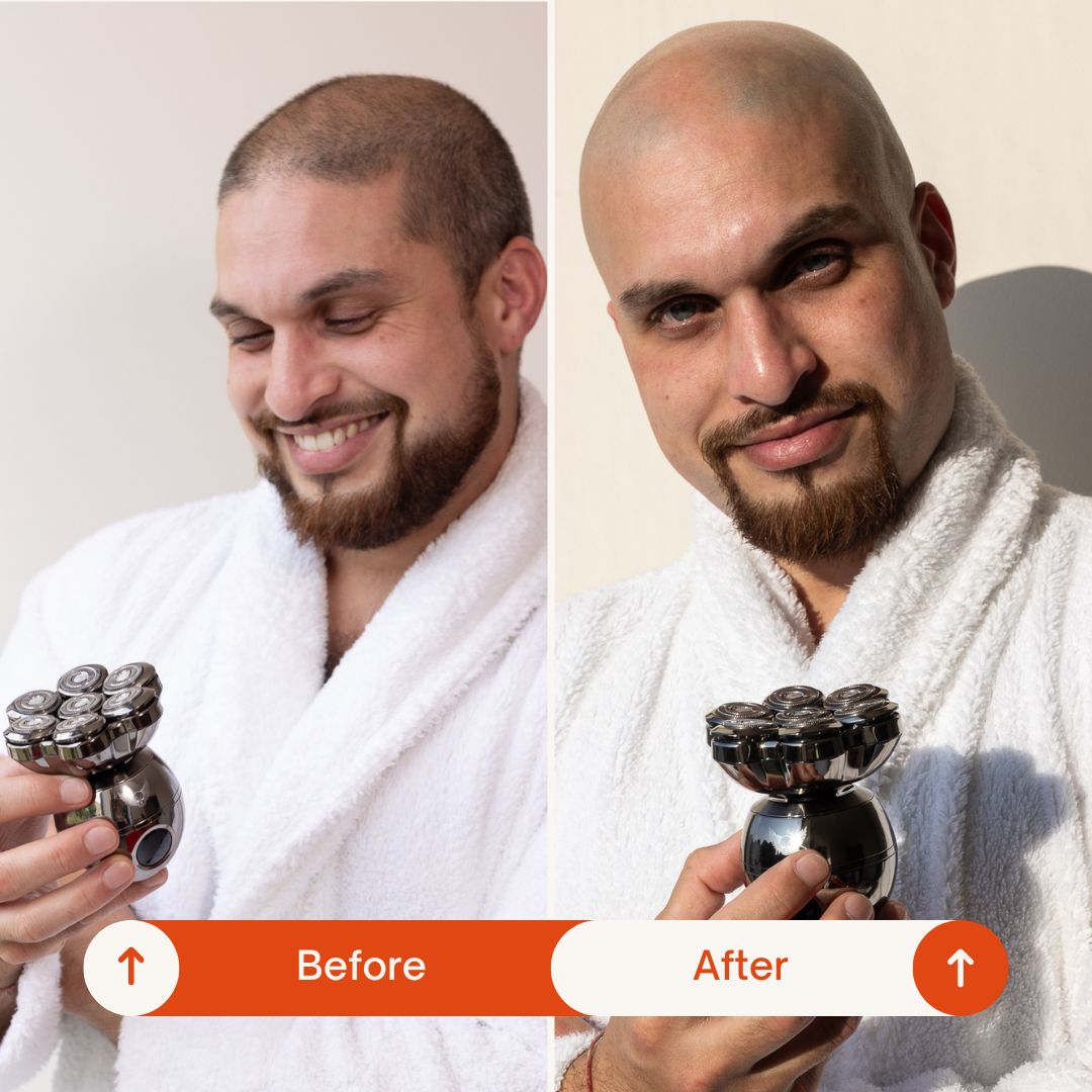 Trimpod 3.0: The Ultimate Shaver for Bald Men